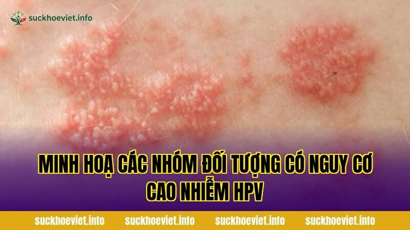 Minh hoạ các nhóm đối tượng có nguy cơ cao nhiễm HPV
