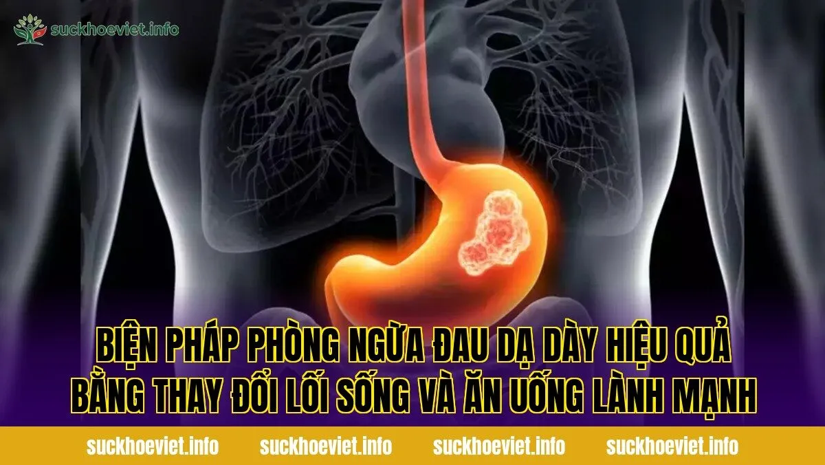 Biện pháp phòng ngừa đau dạ dày hiệu quả bằng thay đổi lối sống và ăn uống lành mạnh
