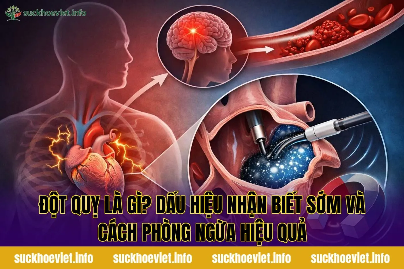 Đột quỵ là gì? Dấu hiệu nhận biết sớm và cách phòng ngừa hiệu quả