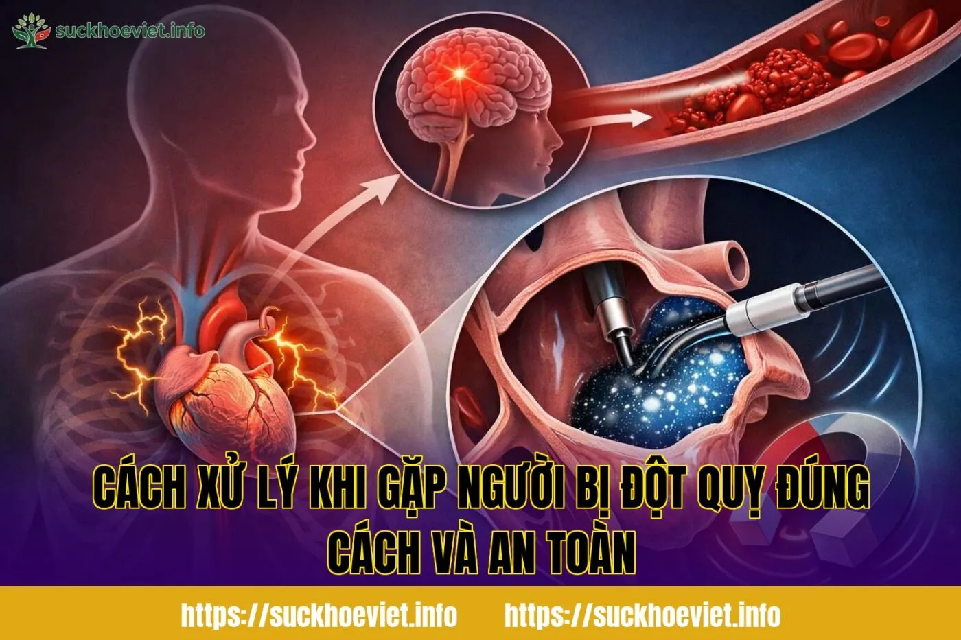 cách xử lý khi gặp người bị đột quỵ đúng cách và an toàn