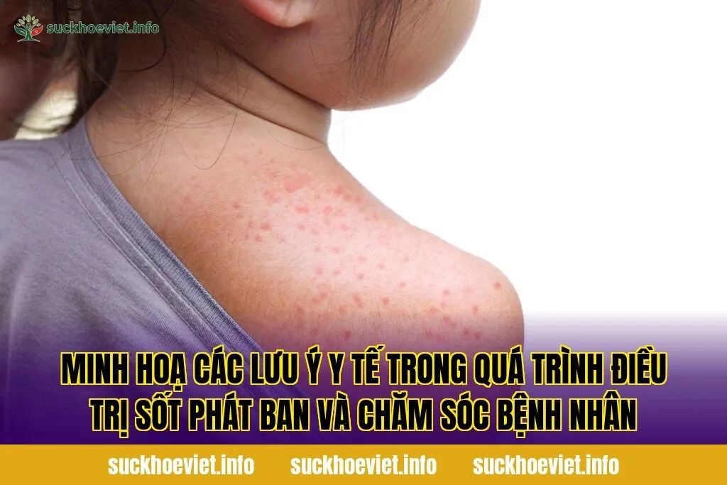 Minh hoạ các lưu ý y tế trong quá trình điều trị sốt phát ban và chăm sóc bệnh nhân