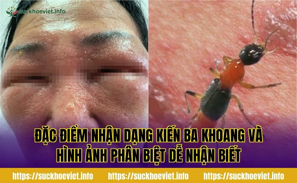 đặc điểm nhận dạng kiến ba khoang và hình ảnh phân biệt dễ nhận biết