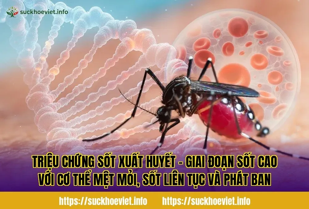 Triệu chứng sốt xuất huyết - Giai đoạn sốt cao với cơ thể mệt mỏi, sốt liên tục và phát ban