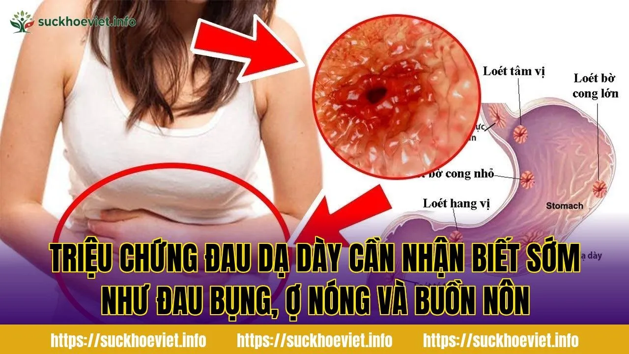 Triệu chứng đau dạ dày cần nhận biết sớm như đau bụng, ợ nóng và buồn nôn