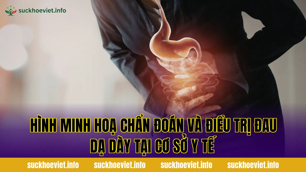 Hình minh hoạ chẩn đoán và điều trị đau dạ dày tại cơ sở y tế