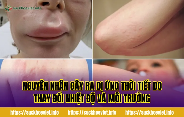 nguyên nhân gây ra dị ứng thời tiết do thay đổi nhiệt độ và môi trường