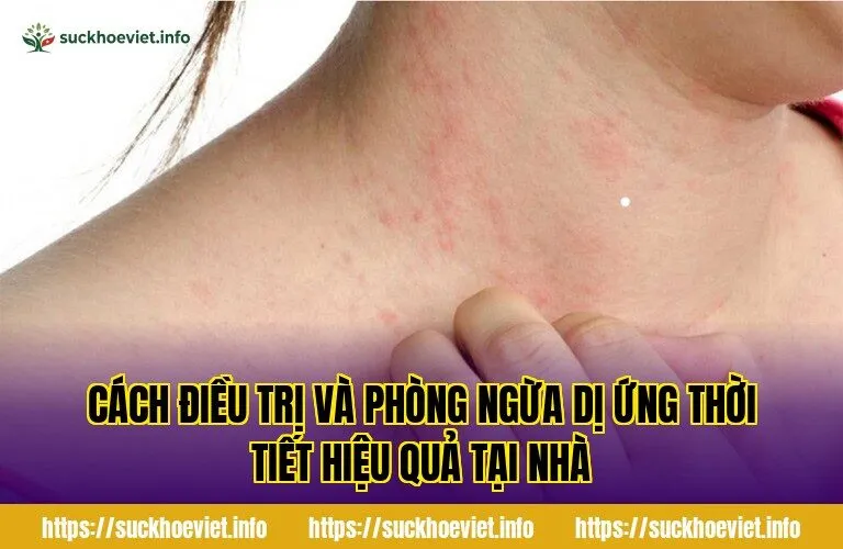 cách điều trị và phòng ngừa dị ứng thời tiết hiệu quả tại nhà