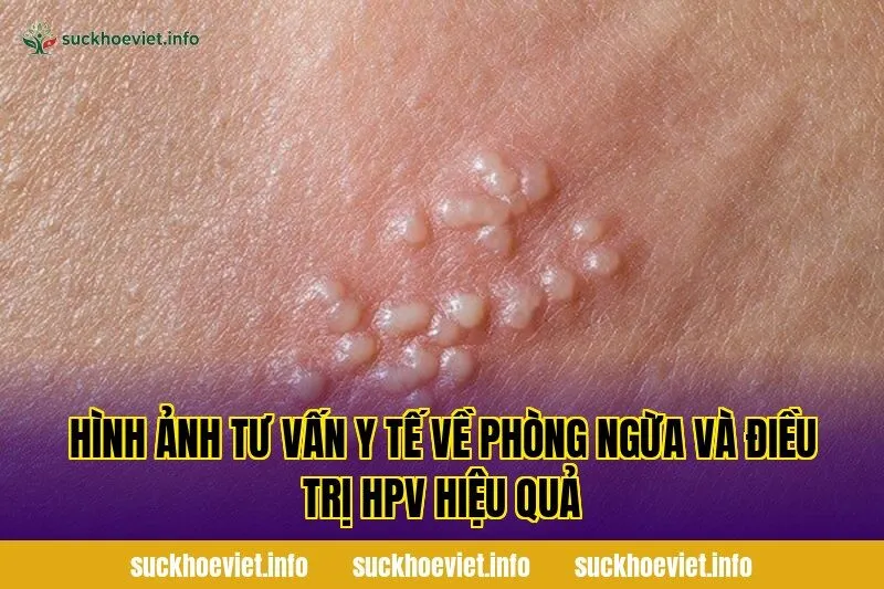 Hình ảnh tư vấn y tế về phòng ngừa và điều trị HPV hiệu quả