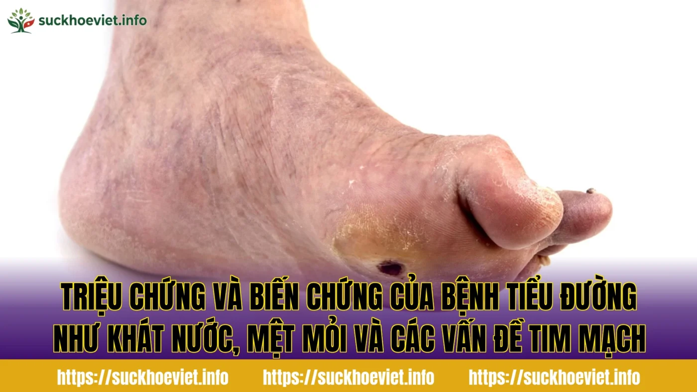 Triệu chứng và biến chứng của bệnh tiểu đường như khát nước, mệt mỏi và các vấn đề tim mạch