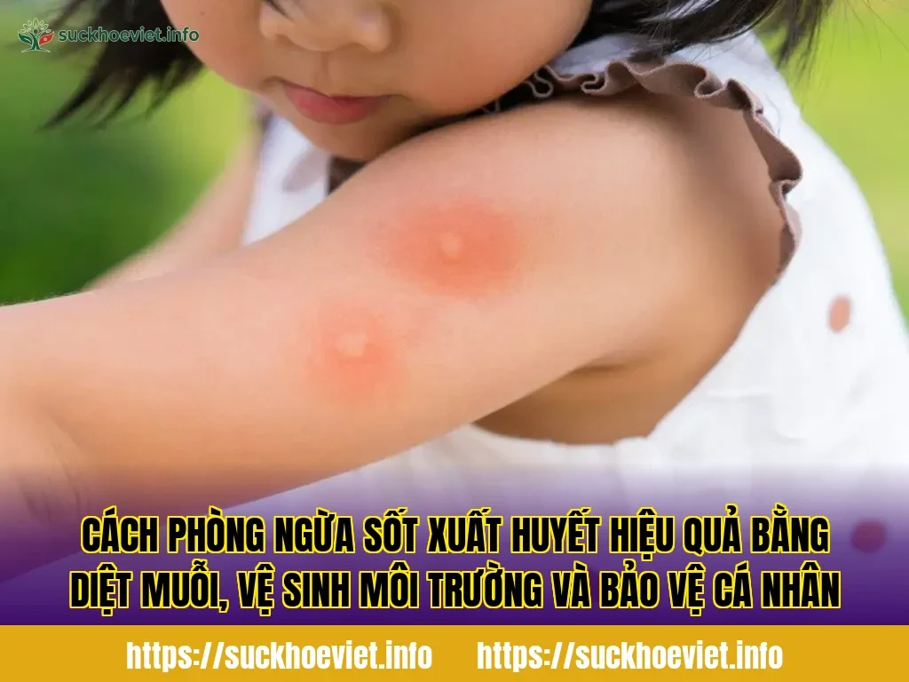 Cách phòng ngừa sốt xuất huyết hiệu quả bằng diệt muỗi, vệ sinh môi trường và bảo vệ cá nhân
