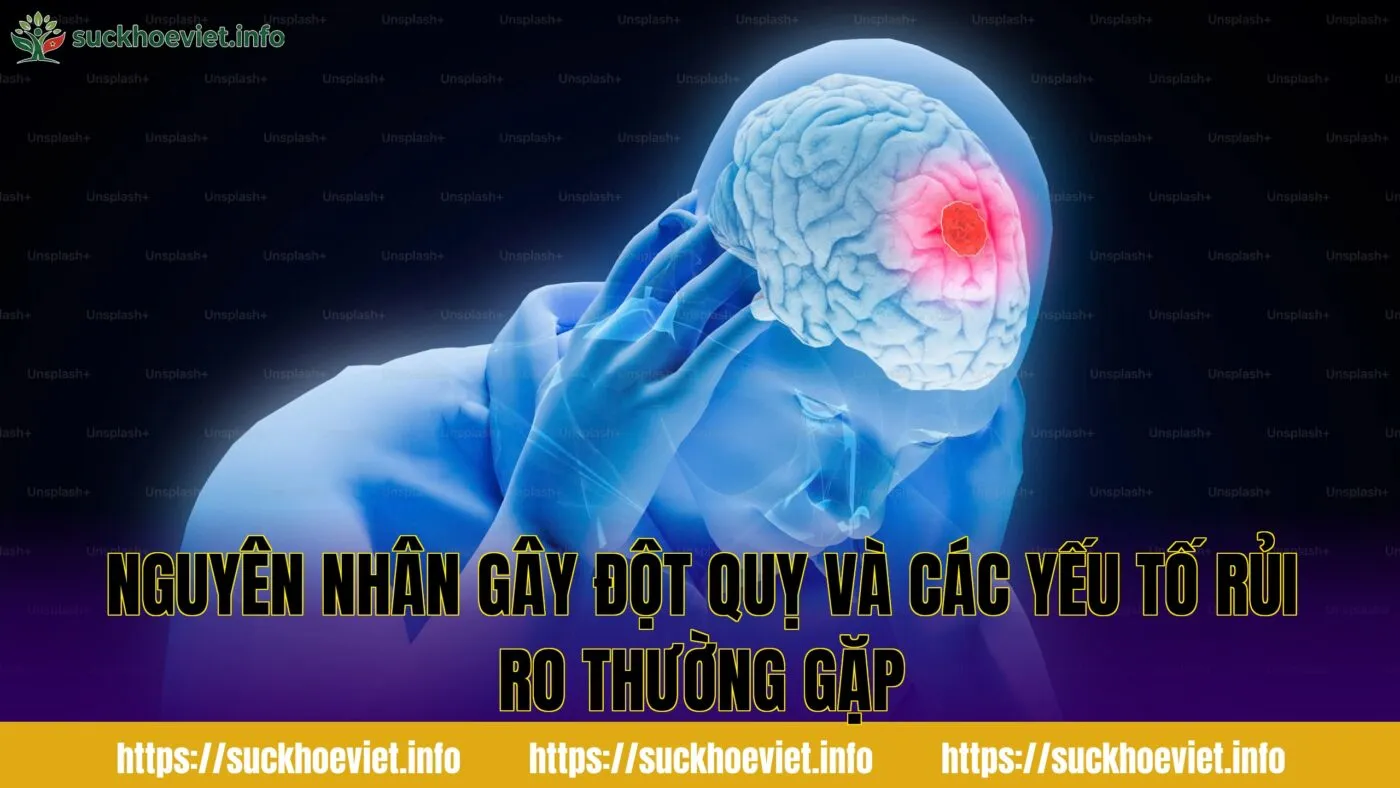 nguyên nhân gây đột quỵ và các yếu tố rủi ro thường gặp