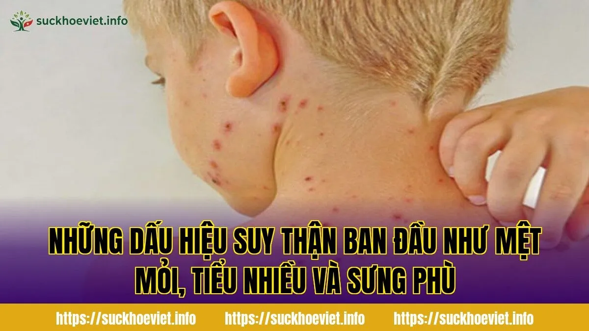 Những dấu hiệu suy thận ban đầu như mệt mỏi, tiểu nhiều và sưng phù