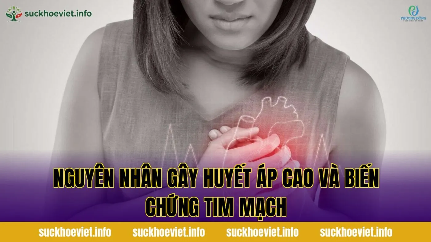 Nguyên nhân gây huyết áp cao và biến chứng tim mạch