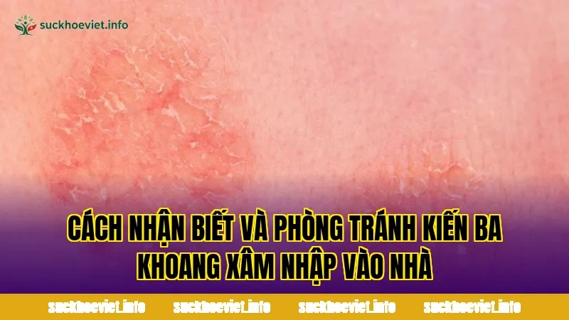 Cách nhận biết và phòng tránh kiến ba khoang xâm nhập vào nhà