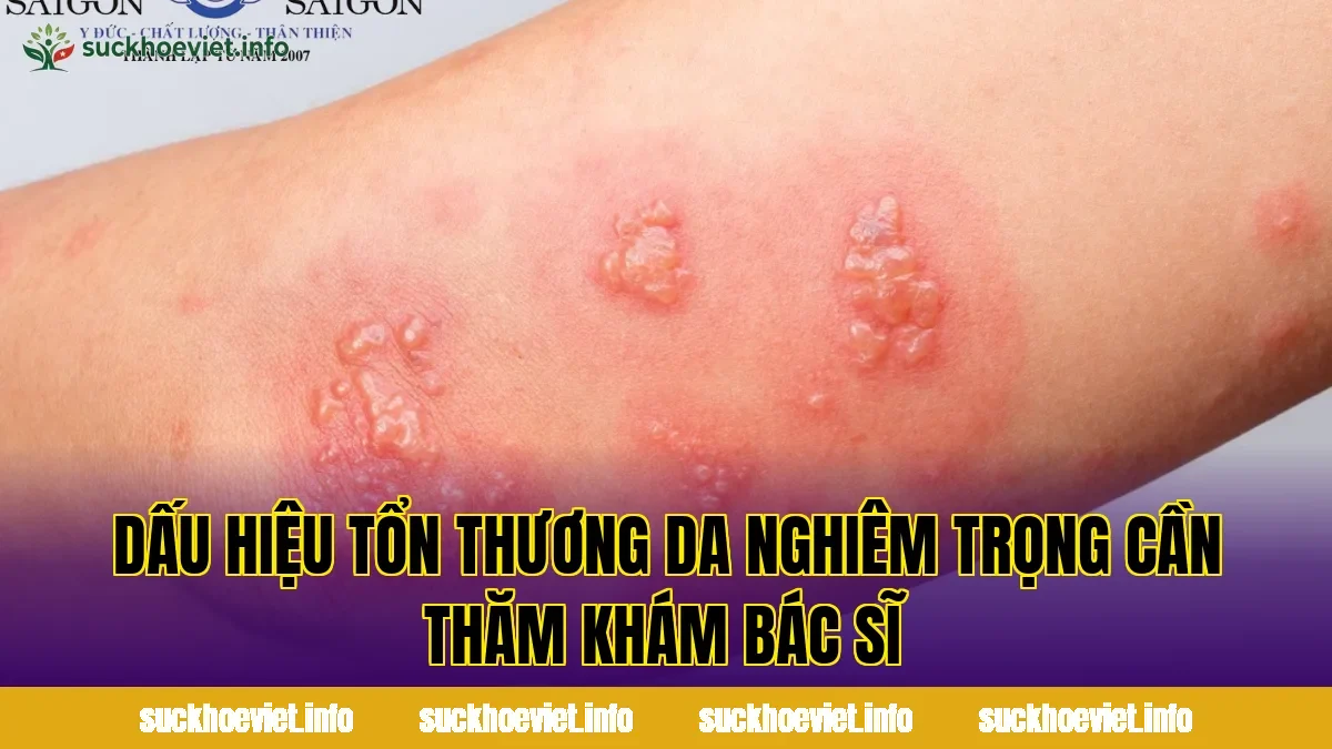 Dấu hiệu tổn thương da nghiêm trọng cần thăm khám bác sĩ