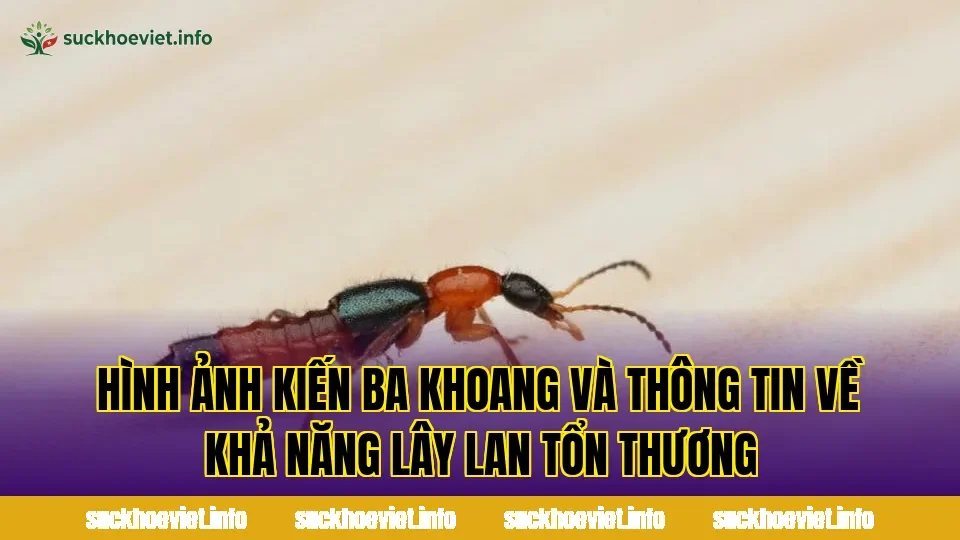 Hình ảnh kiến ba khoang và thông tin về khả năng lây lan tổn thương