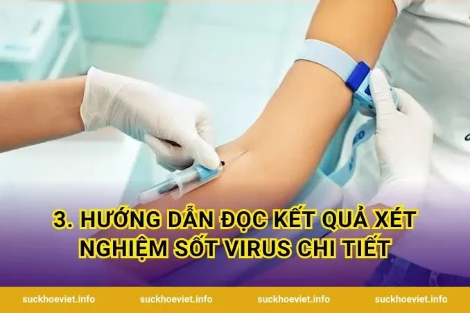 3. Hướng dẫn đọc kết quả xét nghiệm sốt virus chi tiết