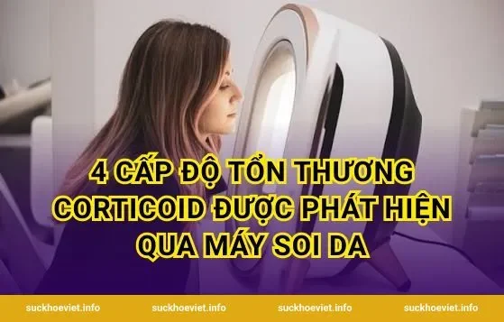 4 Cấp độ tổn thương corticoid được phát hiện qua máy soi da