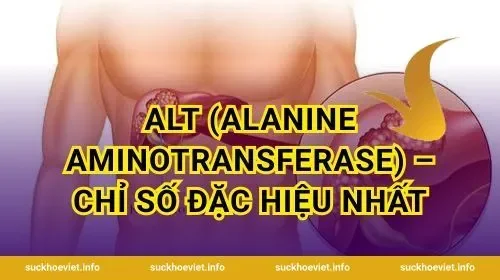 ALT (Alanine Aminotransferase) – Chỉ Số Đặc Hiệu Nhất