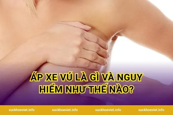 Áp Xe Vú Là Gì Và Nguy Hiểm Như Thế Nào?