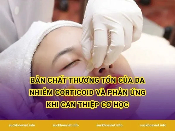Bản chất thương tổn của da nhiễm corticoid và phản ứng khi can thiệp cơ học