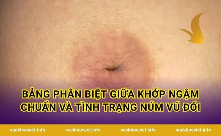Bảng Phân Biệt Giữa Khớp Ngậm Chuẩn Và Tình Trạng Núm Vú Đói