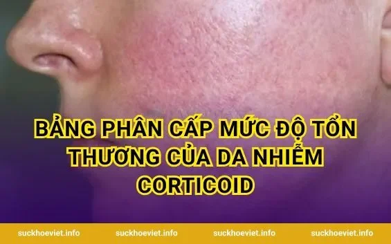 Bảng Phân Cấp Mức Độ Tổn Thương Của Da Nhiễm Corticoid