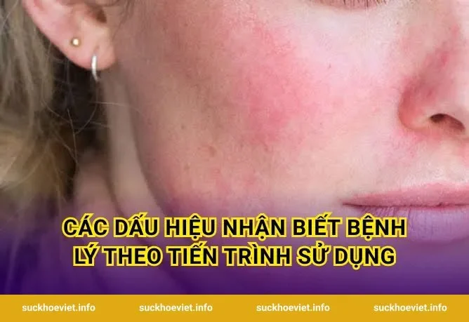 Các Dấu Hiệu Nhận Biết Bệnh Lý Theo Tiến Trình Sử Dụng