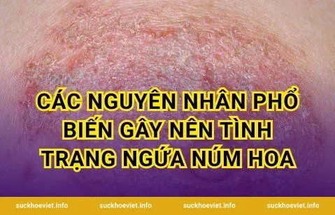 Các nguyên nhân phổ biến gây nên tình trạng ngứa núm hoa