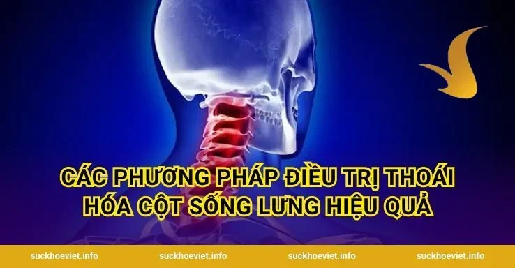 Các Phương Pháp Điều Trị Thoái Hóa Cột Sống Lưng Hiệu Quả
