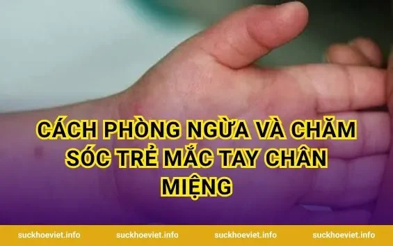Cách phòng ngừa và chăm sóc trẻ mắc tay chân miệng