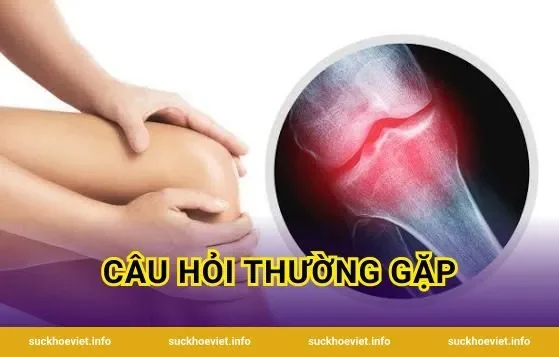 Câu Hỏi Thường Gặp