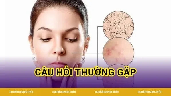 Câu hỏi thường gặp