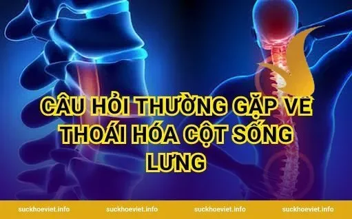 Câu Hỏi Thường Gặp Về Thoái Hóa Cột Sống Lưng