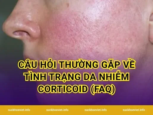 Câu hỏi thường gặp về tình trạng da nhiễm corticoid (FAQ)
