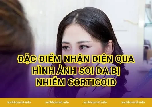 Đặc điểm nhận diện qua hình ảnh soi da bị nhiễm corticoid