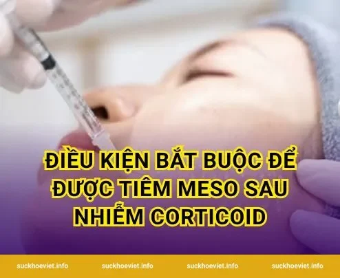 Điều kiện bắt buộc để được tiêm meso sau nhiễm corticoid