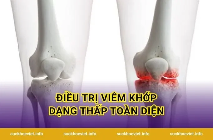 Điều Trị Viêm Khớp Dạng Thấp Toàn Diện