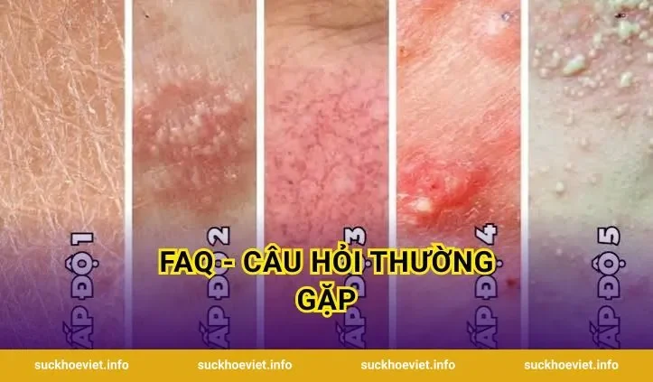 FAQ - Câu Hỏi Thường Gặp