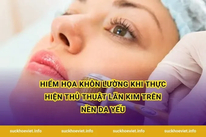 Hiểm họa khôn lường khi thực hiện thủ thuật lăn kim trên nền da yếu