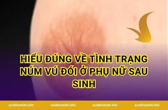 Hiểu Đúng Về Tình Trạng Núm Vú Đói Ở Phụ Nữ Sau Sinh