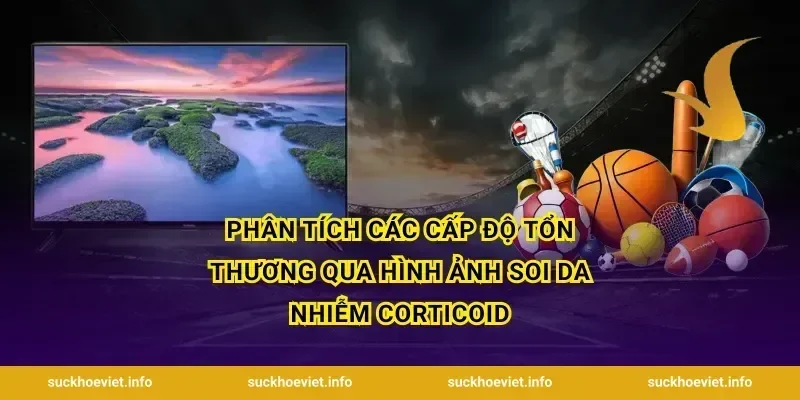 Phân tích các cấp độ tổn thương qua hình ảnh soi da nhiễm corticoid