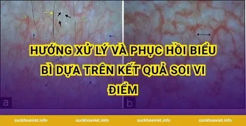 Hướng xử lý và phục hồi biểu bì dựa trên kết quả soi vi điểm