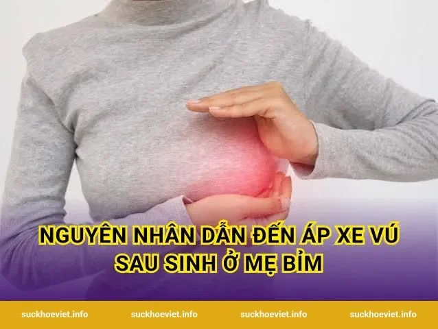 Nguyên nhân dẫn đến áp xe vú sau sinh ở mẹ bỉm