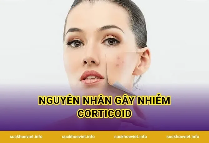Nguyên nhân gây nhiễm corticoid
