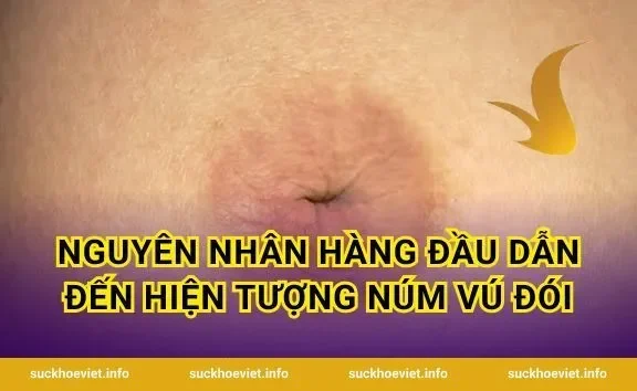 Nguyên Nhân Hàng Đầu Dẫn Đến Hiện Tượng Núm Vú Đói