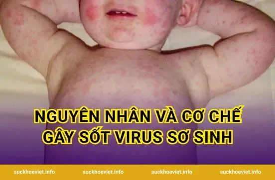 Nguyên nhân và cơ chế gây sốt virus sơ sinh