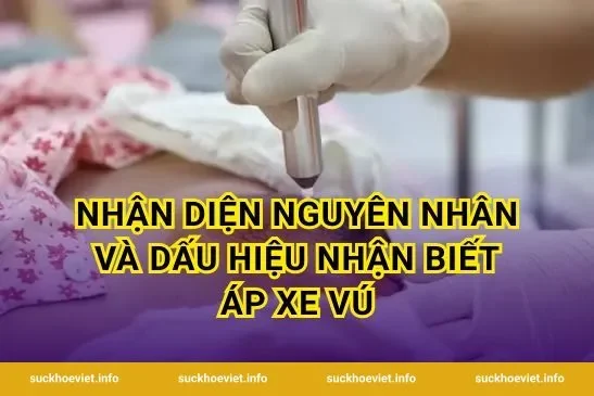 Nhận diện nguyên nhân và dấu hiệu nhận biết áp xe vú