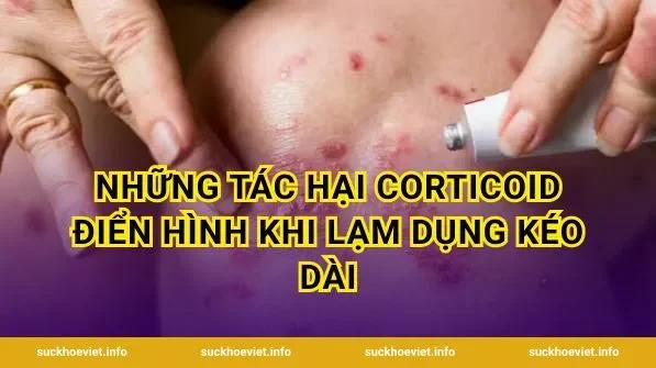 Những tác hại corticoid điển hình khi lạm dụng kéo dài