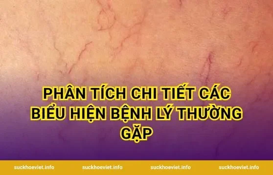 Phân tích chi tiết các biểu hiện bệnh lý thường gặp